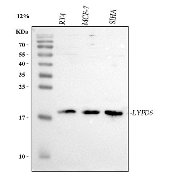 LYPD6 Rabbit Polyclonal Antibody