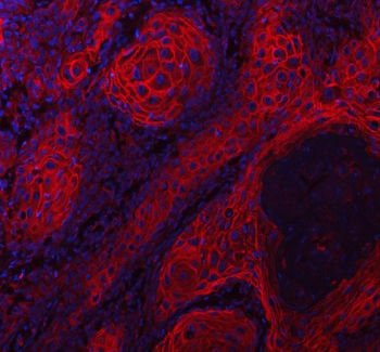 LYPD3 Rabbit Polyclonal Antibody