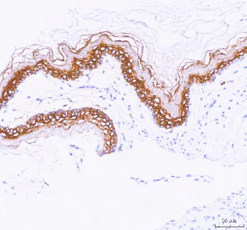 LYPD3 Rabbit Polyclonal Antibody