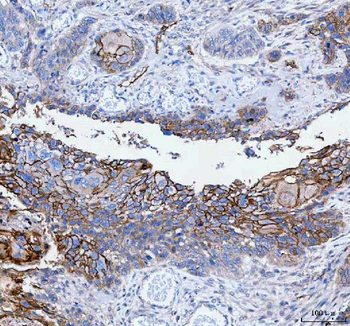 PALM Rabbit Polyclonal Antibody