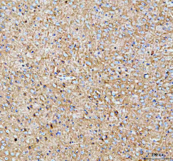 PALM Rabbit Polyclonal Antibody