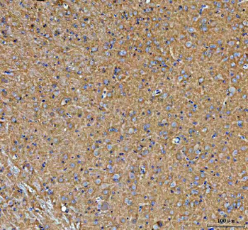 PALM Rabbit Polyclonal Antibody