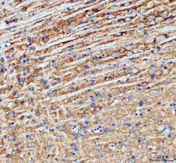 PALM Rabbit Polyclonal Antibody