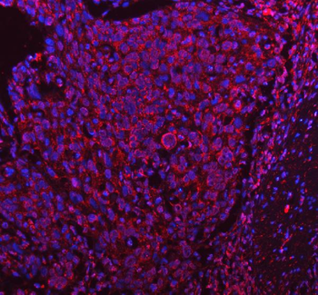 PDK4 Rabbit Polyclonal Antibody