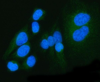 PDK4 Rabbit Polyclonal Antibody