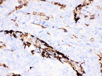Gelsolin Gsn Mouse Monoclonal Antibody