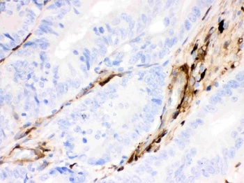 Gelsolin Gsn Mouse Monoclonal Antibody