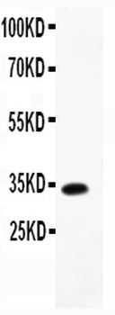 MCP4/CCL13 Rabbit Polyclonal Antibody