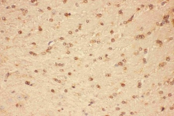 CNTF Rabbit Polyclonal Antibody