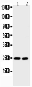 IL6 Rabbit Polyclonal Antibody