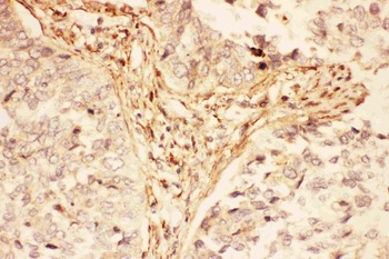 LIF Rabbit Polyclonal Antibody