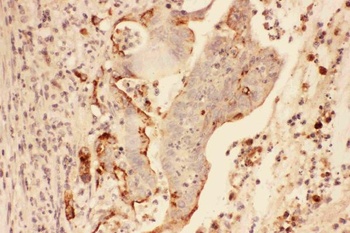 MMP7 Rabbit Polyclonal Antibody