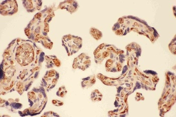 MMP7 Rabbit Polyclonal Antibody