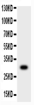 MMP7 Rabbit Polyclonal Antibody