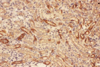 MMP7 Rabbit Polyclonal Antibody