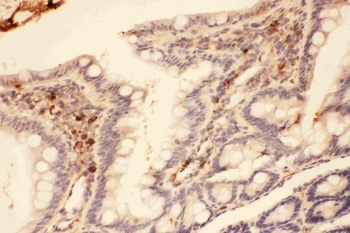 MMP7 Rabbit Polyclonal Antibody