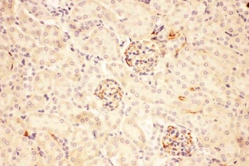 ACTH/POMC Rabbit Polyclonal Antibody