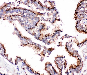 Cathepsin D/CTSD Rabbit Polyclonal Antibody