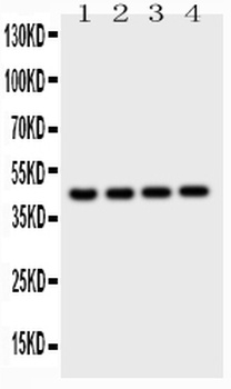 Cathepsin D/CTSD Rabbit Polyclonal Antibody