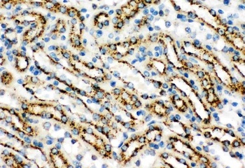 Cathepsin D/CTSD Rabbit Polyclonal Antibody