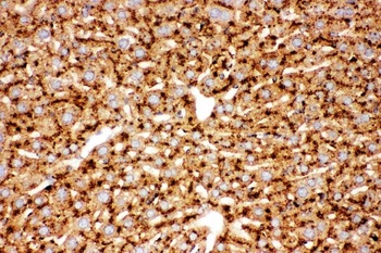 Cathepsin D/CTSD Rabbit Polyclonal Antibody