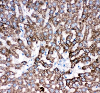 Cathepsin D/CTSD Rabbit Polyclonal Antibody