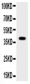 Cathepsin G/CTSG Rabbit Polyclonal Antibody