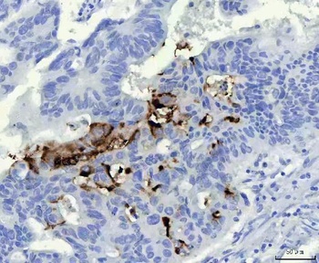 Mucin Gastric MUC5AC Mouse Monoclonal Antibody
