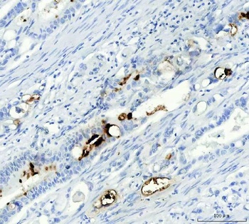 Mucin Gastric MUC5AC Mouse Monoclonal Antibody