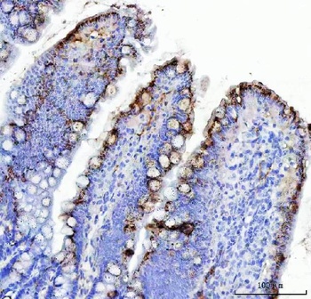 Mucin Gastric MUC5AC Mouse Monoclonal Antibody