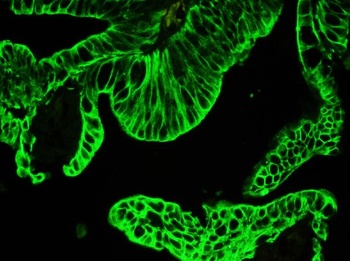 Pan cytokeratin Antibody (Monoclonal, PCK-26)