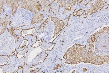 Pan cytokeratin Antibody (Monoclonal, PCK-26)