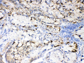 Hepatitis B Virus Rabbit Polyclonal Antibody