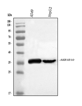 AKR1B10 Antibody