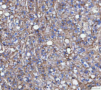 CD166/ALCAM Antibody