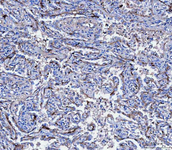 CD166/ALCAM Antibody