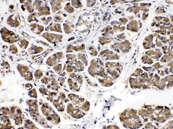 Amylase/AMY1A/AMY1B/AMY1C Rabbit Polyclonal Antibody