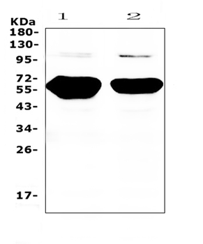 Amylase/AMY1A/AMY1B/AMY1C Rabbit Polyclonal Antibody