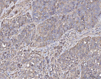 Annexin IV/ANXA4 Antibody