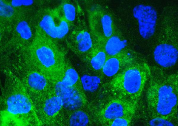 Beta 2 Microglobulin/B2M Rabbit Polyclonal Antibody