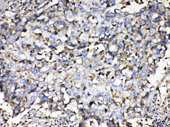Beta 2 Microglobulin/B2M Rabbit Polyclonal Antibody