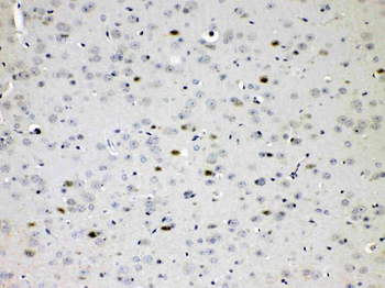 Choline Acetyltransferase/CHAT Rabbit Polyclonal Antibody