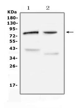 Choline Acetyltransferase/CHAT Rabbit Polyclonal Antibody