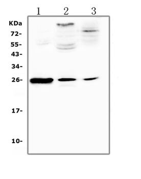C Reactive Protein/Crp Rabbit Polyclonal Antibody