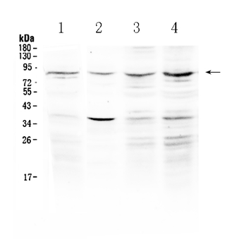 ECE1 Rabbit Polyclonal Antibody