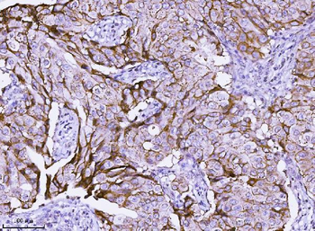 ErbB 2/ERBB2 Rabbit Polyclonal Antibody