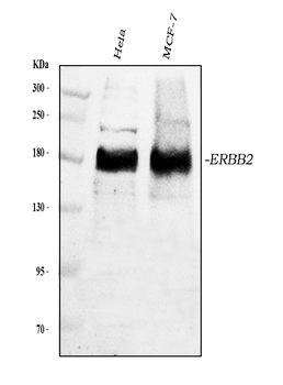 ErbB 2/ERBB2 Rabbit Polyclonal Antibody