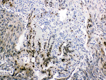 FABP2/I-FABP/FABP Rabbit Polyclonal Antibody