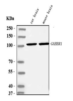 GABA B Receptor 1/GABBR1 Rabbit Polyclonal Antibody