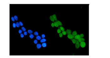 HDAC4 Rabbit Polyclonal Antibody